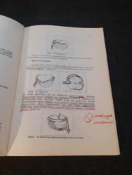 Kroşe Tutuculu Protezler