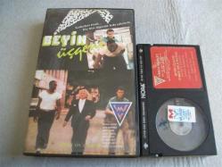 Ü - BETA - BEYİN ÜÇGENİ