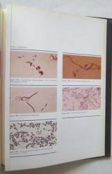 Scope Monograph on Anaerobic Infections