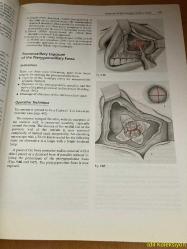 HEAD AND NECK SURGERY - VOLUME 1 FACE , NOSE AND FACİAL SKULL / PART II - H.H. NAUMANN / J. HELMS / C. HERBERHOLD / R.A. JAHRSDOERFER / E.R. KASTENBAUER / W.R. PANJE / M.E. TARDY JR - GEORG THİEME VERLAG - İNGİLİZCE KİTAP (BAŞ BOYUN CERRAHİSİ - CİLT 1 / BÖLÜM II)