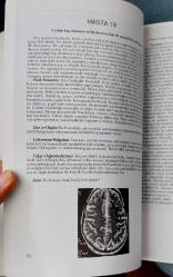 NEUROLOGY PEARLS ( Türkçesi)