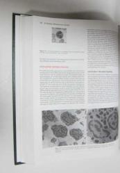 Wintrobe's Clinical Hematology, Volume: 1