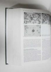 Wintrobe's Clinical Hematology, Volume: 1