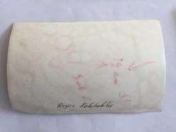 EFSANE MÜZİK GRUBU BEYAZ KELEBEKLER'İN ÇOK NADİR BİR ORİJİNAL FOTOĞRAFI, 18 x 12 cm EBADINDA, SİYAH & BEYAZ - BEYAZ KELEBEKLER'İN KAZADA YAŞAMINI YİTİREN ÜYESİ BEHZAT KUTLUBAĞ'IN KAZA ÖNCESİNDE HASTANEDE TEDAVİ EDİLDİĞİ VE DOKTOR MUAYENESİ GÖRDÜĞÜ BİR DÖNEMDEN KARE, 1960'LAR