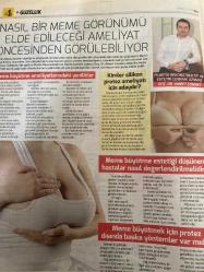 HÜRRİYET GAZETESİ HÜRRİYET KELEBEK 2 GAZETESİ DOĞUM GÜNÜ GAZETESİ - 3 Ekim 2017 - erkeklerin saçları neden dökülür-saç ekimi için güvenilir ve kaliteli bir kliniği nasıl bulabilirim-karma rinoplasti ile burun estetiği-ameliyatlarda burun kırma işlemi yapılıyor mu-nasıl bir meme görünümü elde edileceği ameliyat öncesinden görülebiliyor-meme büyütme estetiği düşünen hastalar nasıl değerlendirilmelidir-doktor Melike külahçı-plastik rekonstrüktif ve estetik cerrahi uzmanı Aykut Özpür-kaş ekiminde hangi kıl kullanılır-karma teknikte morluk olur mu-Ahmet Sönmez-meme büyütmek için protez dışında başka yöntemler var mıdır