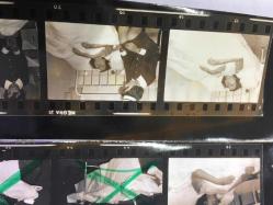 TÜRKAN ŞORAY'IN 1972 YILINDA,Elazığ’da film çekimi sırasında ATTAN DÜŞÜP YARALANDIĞI OLAY SONRASINDA HASTANEDE ÇEKİLMİŞ FOTOĞRAFLARIN 2 ADET DİASI (POZİTİFLER) ve 8 KARE KÜÇÜK HALİNDE TEK FOTOĞRAF (HER KARE 3,5 x 3 cm MİNİ BOYDADIR) - HEPSİ SET HALİNDE, DÖNEMİNE AİT ORİJİNAL AJANS ARŞİVİNDEN/