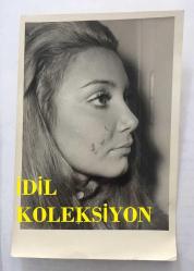 1965 TÜRKİYE GÜZELİ SEVTAP ETİ'NİN ORİJİNAL 2'Lİ FOTOĞRAF SETİ - 18 x 12 cm EBADINDA  - SEVTAP ETİ KAZADAN SONRA YANAĞINDA OLUŞAN YARA İZİNİ GÖSTERİRKEN ÇEKİLMİŞ 2 FARKLI FOTOĞRAF