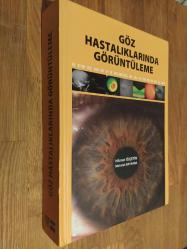Göz Hastalıklarında Görüntüleme