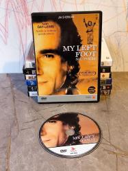 Sol Ayağım/My Left Foot