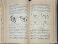 1890 Baskısı Dr.Johannes Hanfe Tarafından Hazırlanmış Der Mensch İsimli Sağlık Kitabı (1.Cilt) 616 Sayfa, Eksik Sayfaları Var
