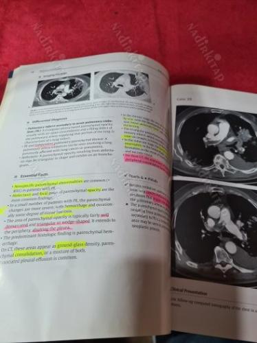 RadCases Thoracic Imaging