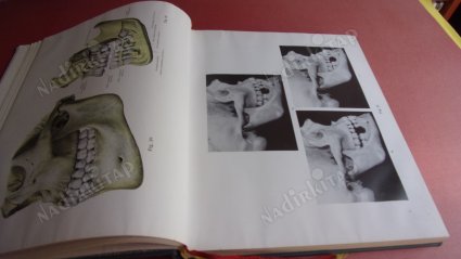 ATLAS DER ANATOMIE DES MENSCHEN .2.TEİL