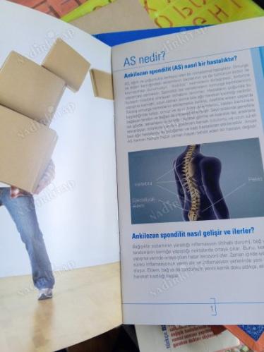 Ankilozan Spondilit Hastalık Bilgilendirme Rehberi + CD