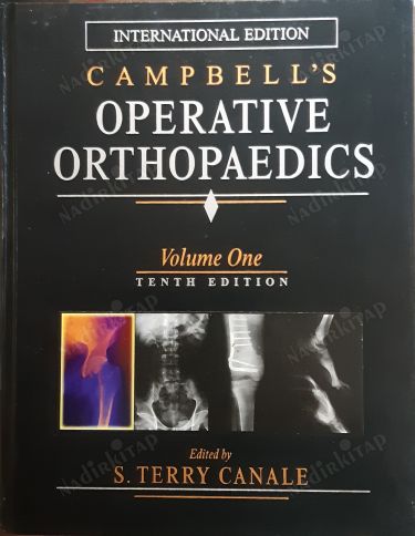 Campbell's Operative Orthopaedics, 4-Volume Set
