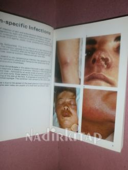 A COLOUR ATLAS OF GENERAL SURGICAL DIAGNOSIS PART 1 OF-2
