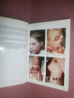 A COLOUR ATLAS OF GENERAL SURGICAL DIAGNOSIS PART 1 OF-2