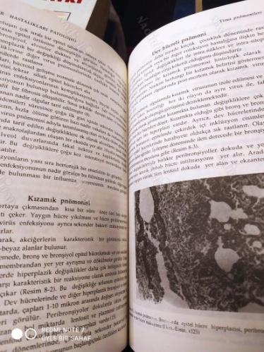 Akciğer Hastalıkları Patolojisi