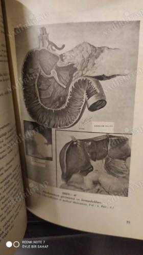 Sistematik Gastroenteroloji Cilt 2 -Mide ve Hastalıkları Normal Mide, Deneysel Ülser, Özel Muayene Metodları) 1.Kitap