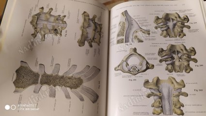 Sobotta Atlas Der Anatomie Des Menschen 3 Teil (İnsan Anatomisi Atlası)