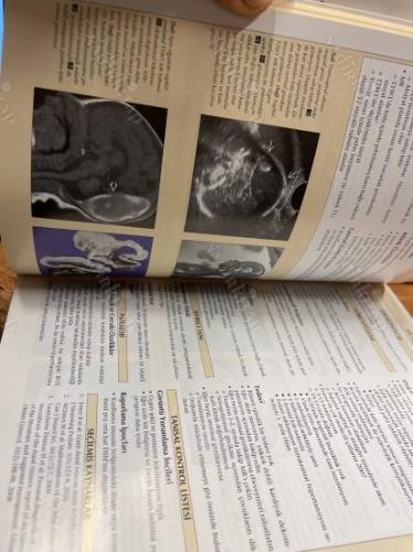 DIAGNOSTIC IMAGING OBSTETRİ - İKİNCİ BASIM / CİLTLİ